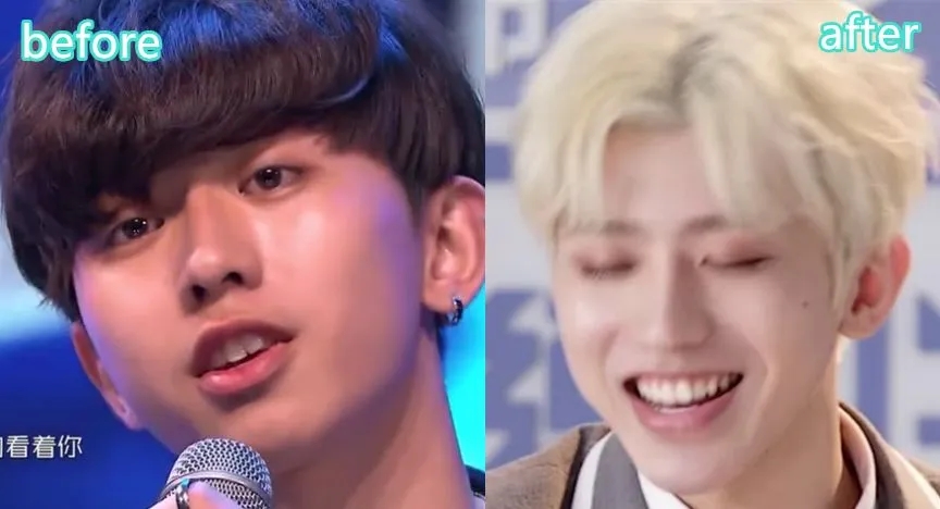 蔡徐坤整牙前图片,蔡徐坤整牙前后照片