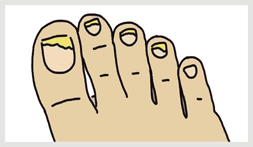 女人美甲到底该不该做,美甲指甲表面开裂是怎么回事