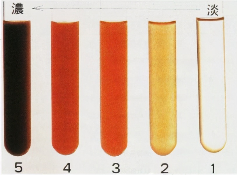 尿黄异味有泡沫是肾有问题吗,尿尿泡沫很多有沉淀物