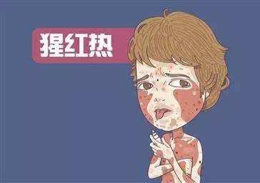 喉咙肿痛胸口起疹子,喉咙痛发热身上起疹子