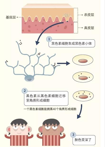 兽皮痣通过什么方式可以查出来,兽皮痣必须治疗吗