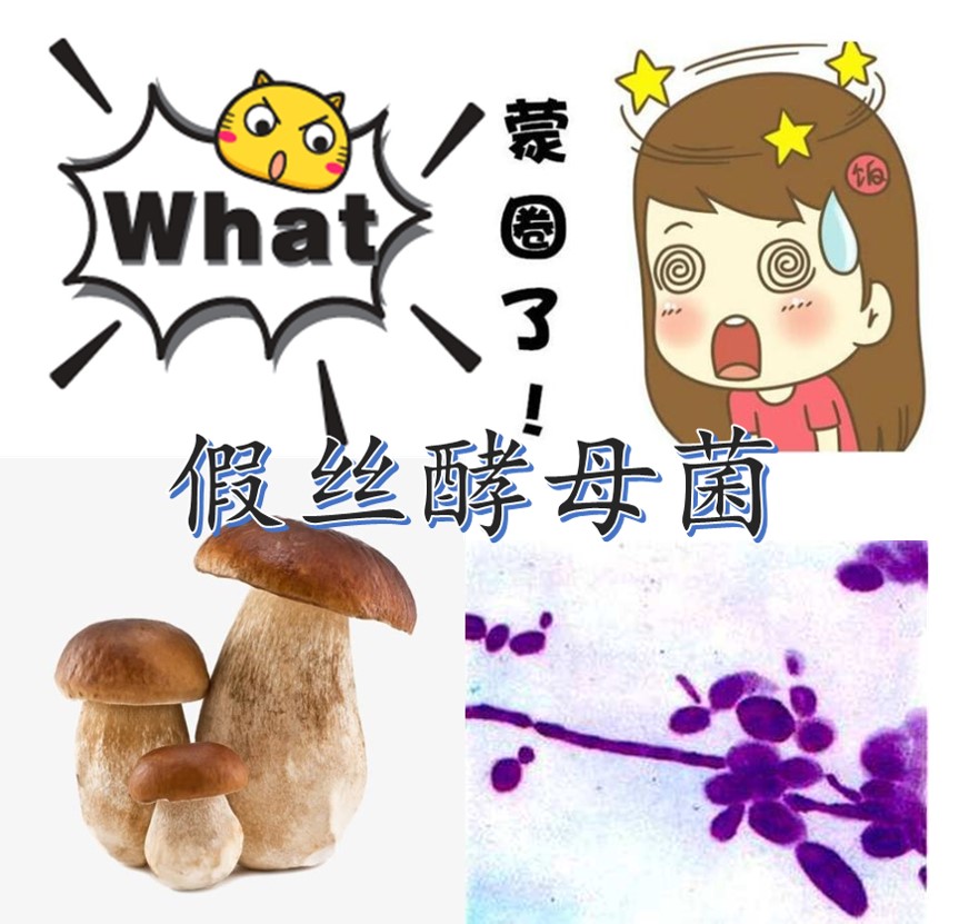 霉菌痒吗,肛门瘙痒霉菌