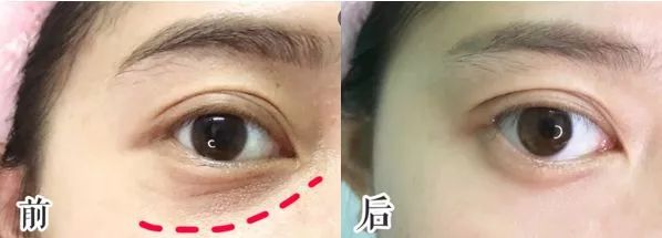 何洁怎么和以前长得不一样了,何洁的造型越来越暗黑了