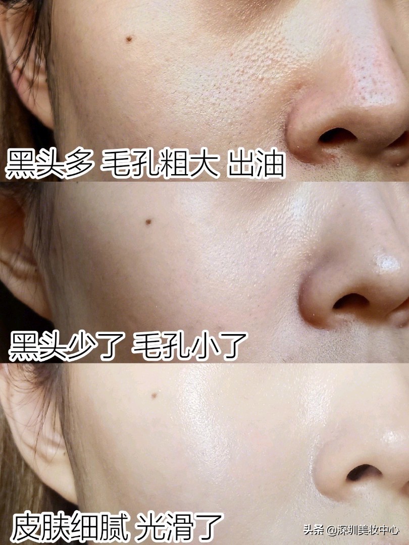 种草美白淡斑,种草皮肤