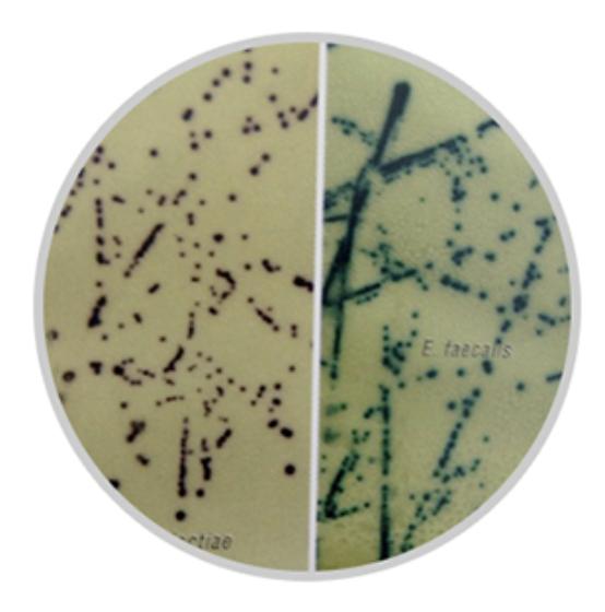 b族链球菌培养及鉴定阳性,b群链球菌培养及检测