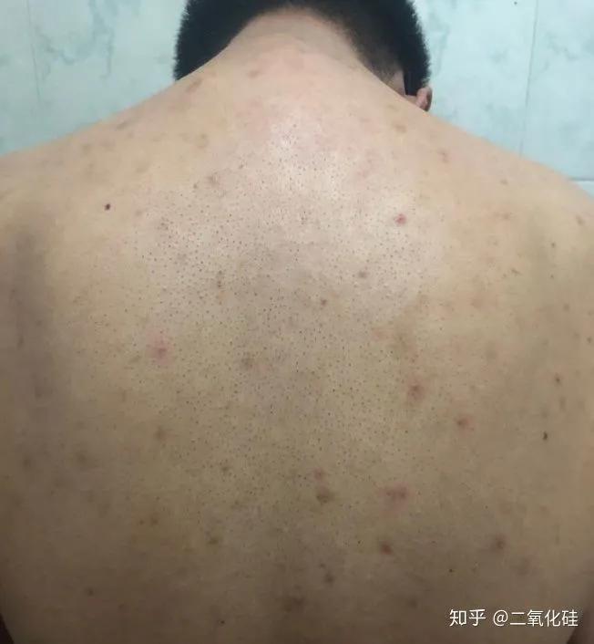 淘宝上十几块钱的衣服能穿吗 (在淘宝买海外自营的衣服能穿吗)