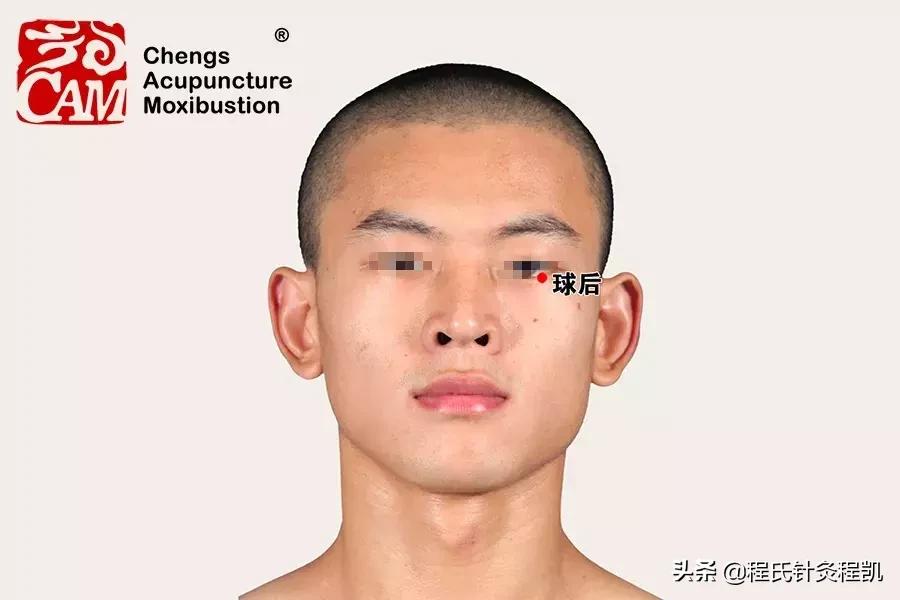 黄斑变性的中医治疗和穴位,中医眼科专家治疗黄斑变性