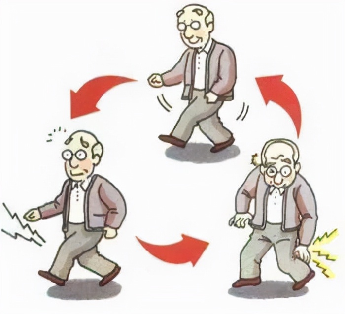 腿痛无力?走路不稳?出现走路问题怎么区别胸椎狭窄or腰椎狭窄?