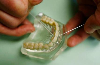 口腔护理牙缝清洁,牙缝清洁是每个牙缝都要清洁吗