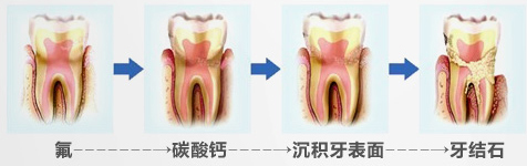 抽烟人的牙膏推荐,澳洲本命牙膏测评