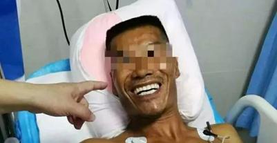 一文读懂水浒,一文读懂脑卒中