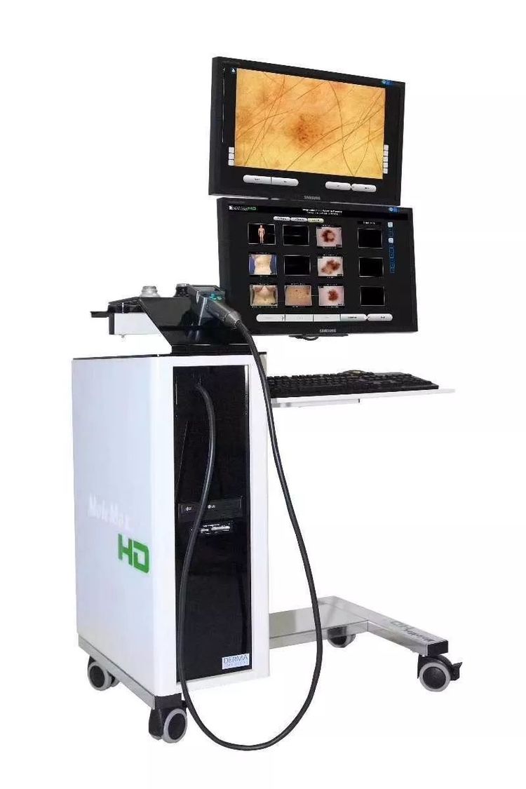 激光点痣不小心照了紫灯怎么办,切除黑色素痣可能癌变吗