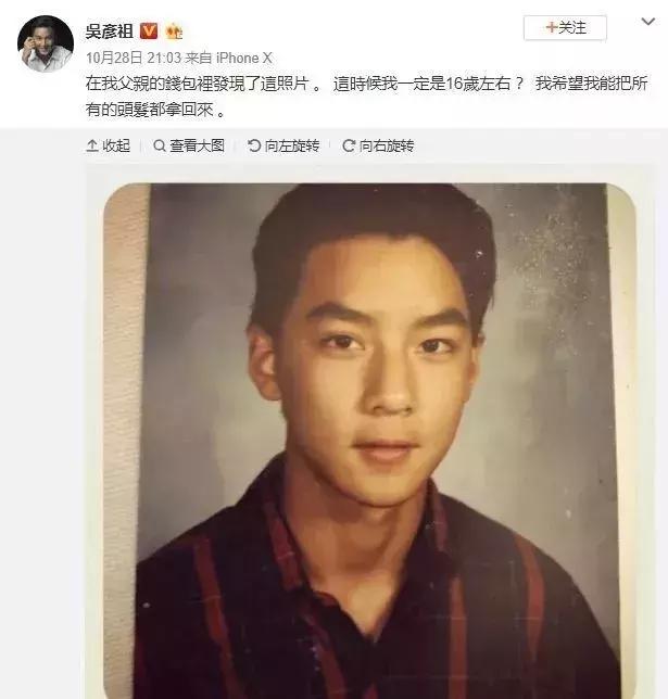 你掉的每根头发都是安全感,你掉的一根头发会怎么样