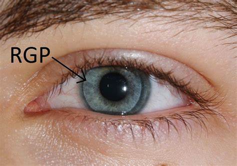 偶尔戴隐形眼镜选择哪种,隐形眼镜选择含水量多少合适