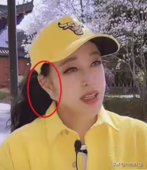 有哪些明星过度整容惨不忍睹,整容失败女明星今昔对比