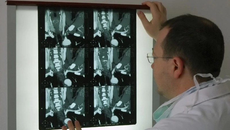 澳洲新冠患者情况,澳洲新冠医院现状