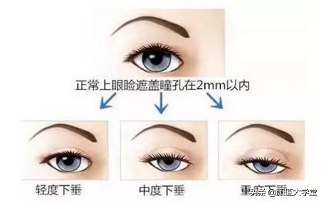 眼睛无神呆滞不灵活,眼睛无神呆滞精神涣散