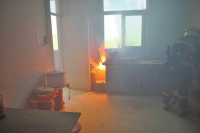 儿童烧伤疤痕到底能不能治愈,烧伤后的紧绷痛感多久才消失