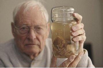 爱因斯坦是谁把他大脑偷走了,爱因斯坦死后他的脑子怎么了