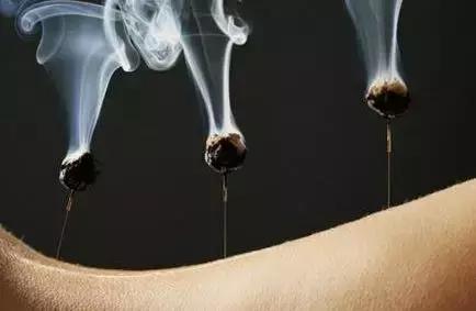 针灸治疗疼痛的偏方,针灸治疗腰疼痛的偏方