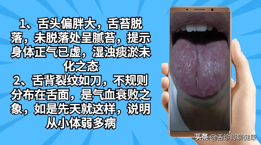 舌诊哥肝郁脾虚,抖音舌诊哥的感悟