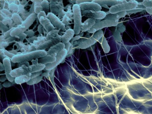 创面细菌生物膜处理方法,细菌生物膜与慢性创面感染