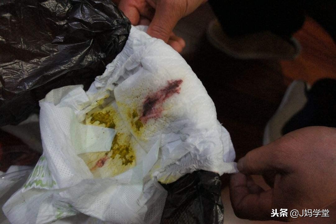 新手父母一定要掌握的9个换纸尿裤技巧,宝宝屁股干爽不遭罪