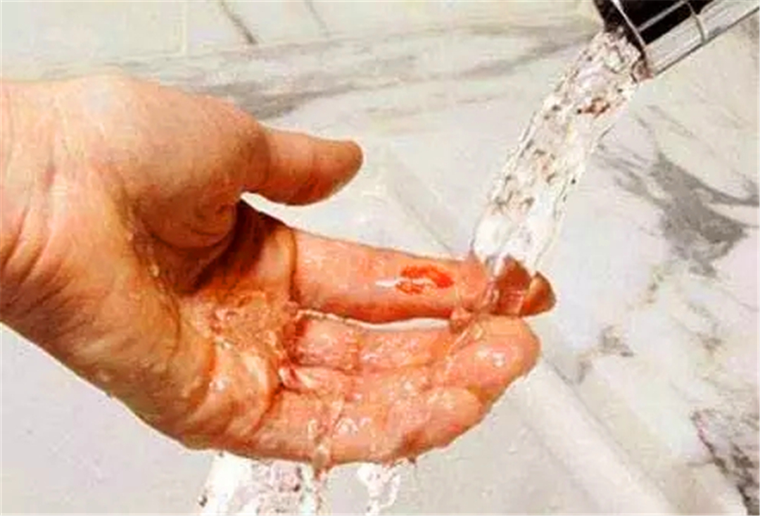 被猫抓伤可能患病的症状,如果被猫抓伤得病是什么症状