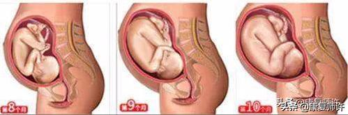 产后腹直肌分离恢复瘦肚子训练,产后腹直肌分离恢复的最佳方法