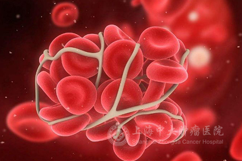 癌症并发真菌感染,癌症合并感染