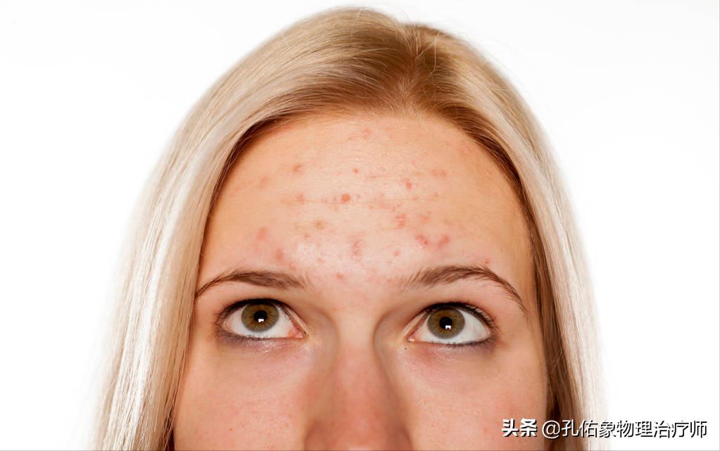 多年的老年斑消除最好的方法,为什么会长老年斑如何可以去除