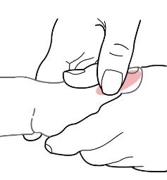 咳嗽肺炎了怎样治疗,感冒咳嗽肺炎吐灰痰