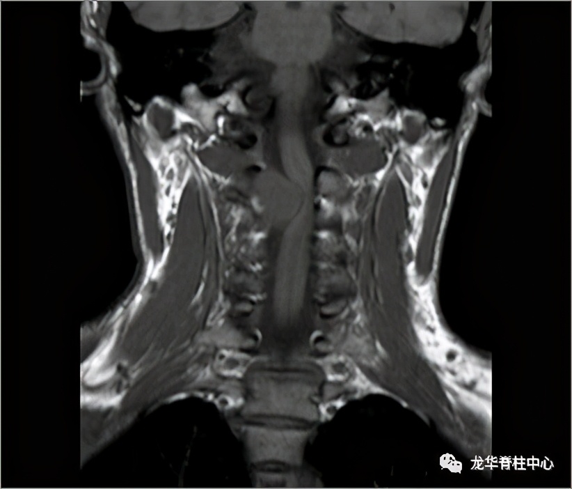 深圳市龙华区人民医院脊柱外科简介