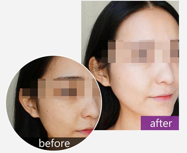 干得起皮泛红怎么办,皮肤干燥拯救大干皮