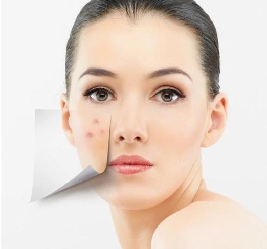 换季一直长痘用什么祛痘产品,痘痘反反复复怎么办如何正确祛痘