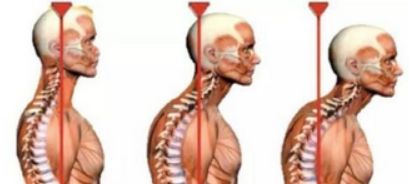 脖子难受怎么办呢,脖子不舒服该怎么办