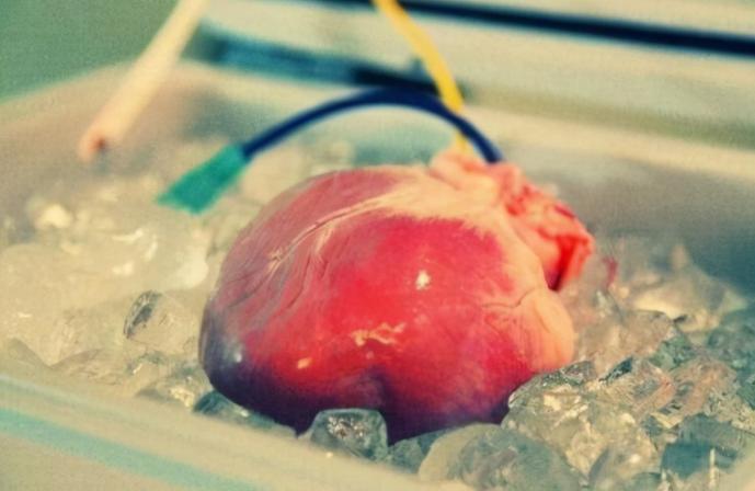 80年代移植狒狒心脏的婴儿,第一个移植狒狒心脏的美国女孩