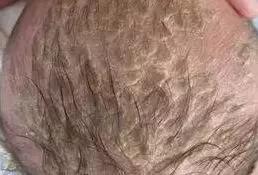 宝宝头垢正确清理方法吴医生,初生婴儿头上脏怎么办