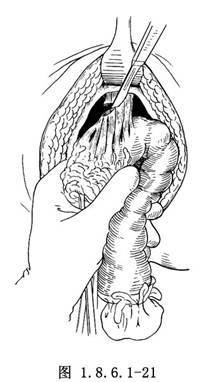 养牛户们最应该注意的这种病，严重影响母牛的繁育，值得学习转发