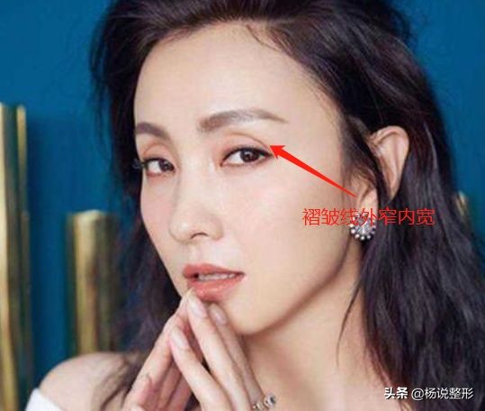 割双眼皮一定好看吗,割双眼皮真的好看吗