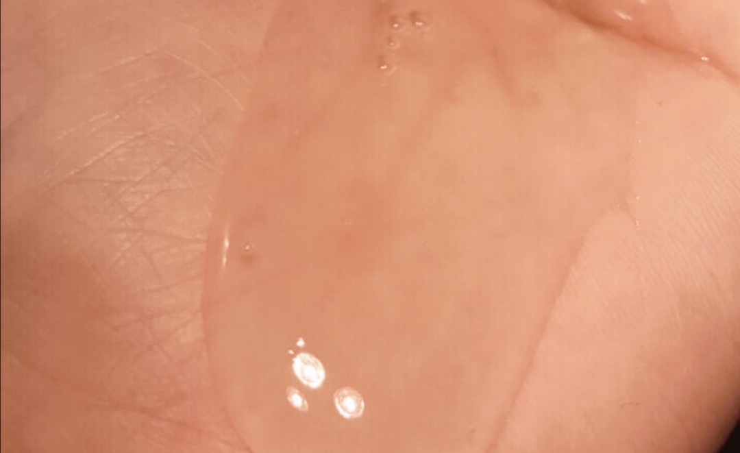 海飞丝洗发水用几次才能没有头屑,海飞丝洗发水哪款去头屑效果好