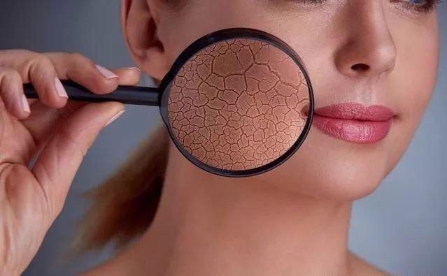 我的皮肤偏干性该怎么办,敷面膜皮肤还是干