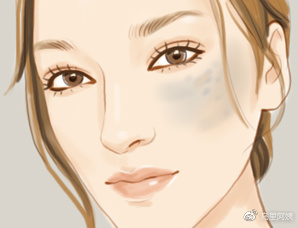 雀斑、*褐斑黄**、咖啡斑、晒斑、妊娠斑...分不清还谈什么祛斑