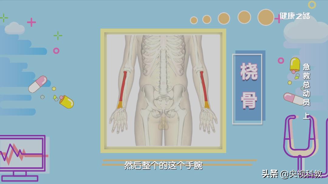 腿扭伤后导致股骨头骨折,摔伤趾骨骨折