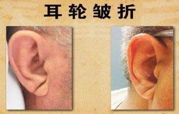 出现这八大症状警惕心血管病,出现这几种症状说明心脏病严重