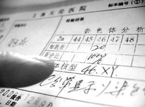 双性人是怎么形成的原因是什么,双性人是哪两种生殖系统