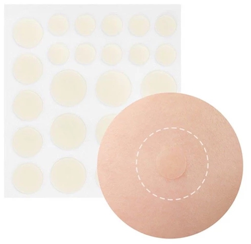 贴痘痘贴后要做什么,贴完痘痘贴要怎么处理