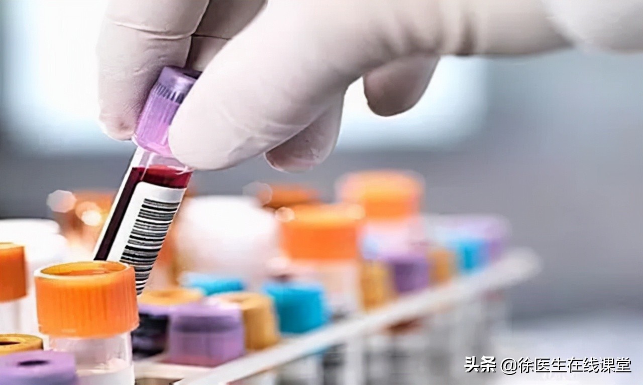 乙肝病毒携带者需要过分担心,乙肝携带者能过日子吗