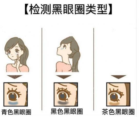 用了很多眼霜还是有黑眼圈？别怪产品太鸡肋，只能说是你没选对