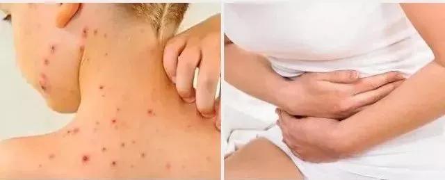 洗衣粉过敏起的红疹多长时间自愈,洗衣服后过敏胳膊上起红疹